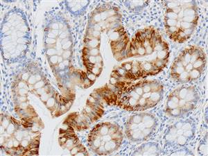 3233B | Control Slides:Immunopathology; Cytokeratin 20 (CK20)